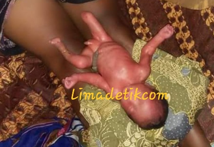 Heboh! Warga Talango Temukan Bayi dengan Anggota Badan Seperti Ini 1 20190306 142134