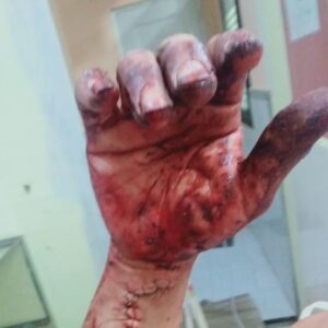 Ketahuan Keluar Kamar Istri Orang, Pria di Sumenep Dibacok