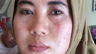 Buntut dari Penganiayaan, Oknum Kades di Sumenep Dilaporkan ke Polisi