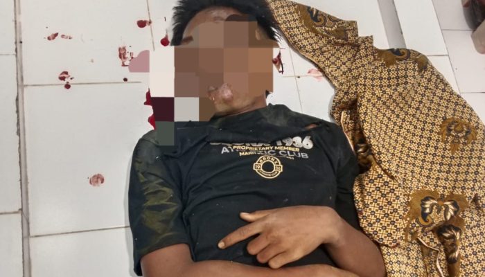 Identitas Misterius Terungkap, Korban Laka Maut di Sumenep Ternyata Pelajar 16 Tahun
