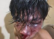 Dikeroyok Sejumlah Orang Tak Dikenal, Warga Taman Sidoarjo Alami Luka Berat