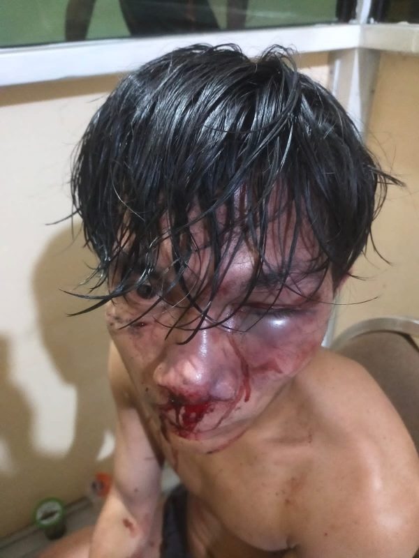 Dikeroyok Sejumlah Orang Tak Dikenal, Warga Taman Sidoarjo Alami Luka Berat