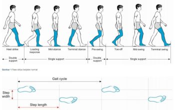 Cegah Disfungsi Ambulasi dan Memperkokoh Postur Tubuh dengan Gaya Berjalan